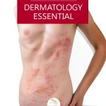 Knowledge flow Dermatology eBook Medical Sciences Series-0